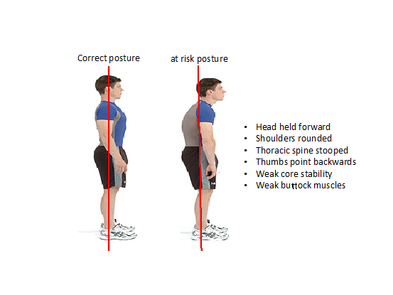 bursa impingement symptoms)